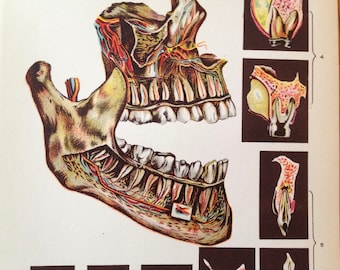 Human Anatomy Tooth Disease Creepy Tooth Fairy 1908 Medical Dental Illustration