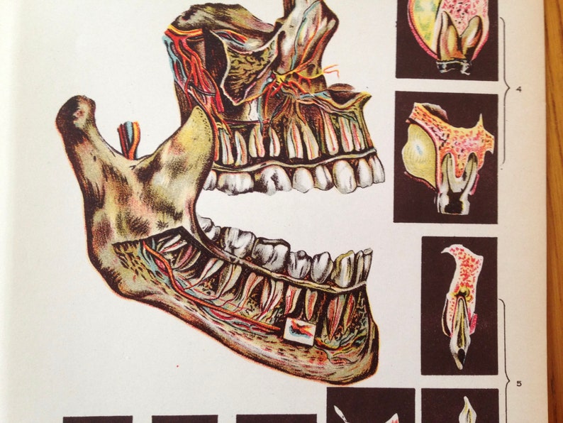 Human Anatomy Tooth Disease Creepy Tooth Fairy 1908 Medical Dental Illustration image 1