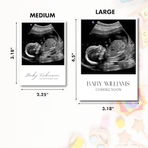 Sonogram Magnets Personalised Baby Ultrasound Magnets | Custom Keepsake | Ideal Gift for ...