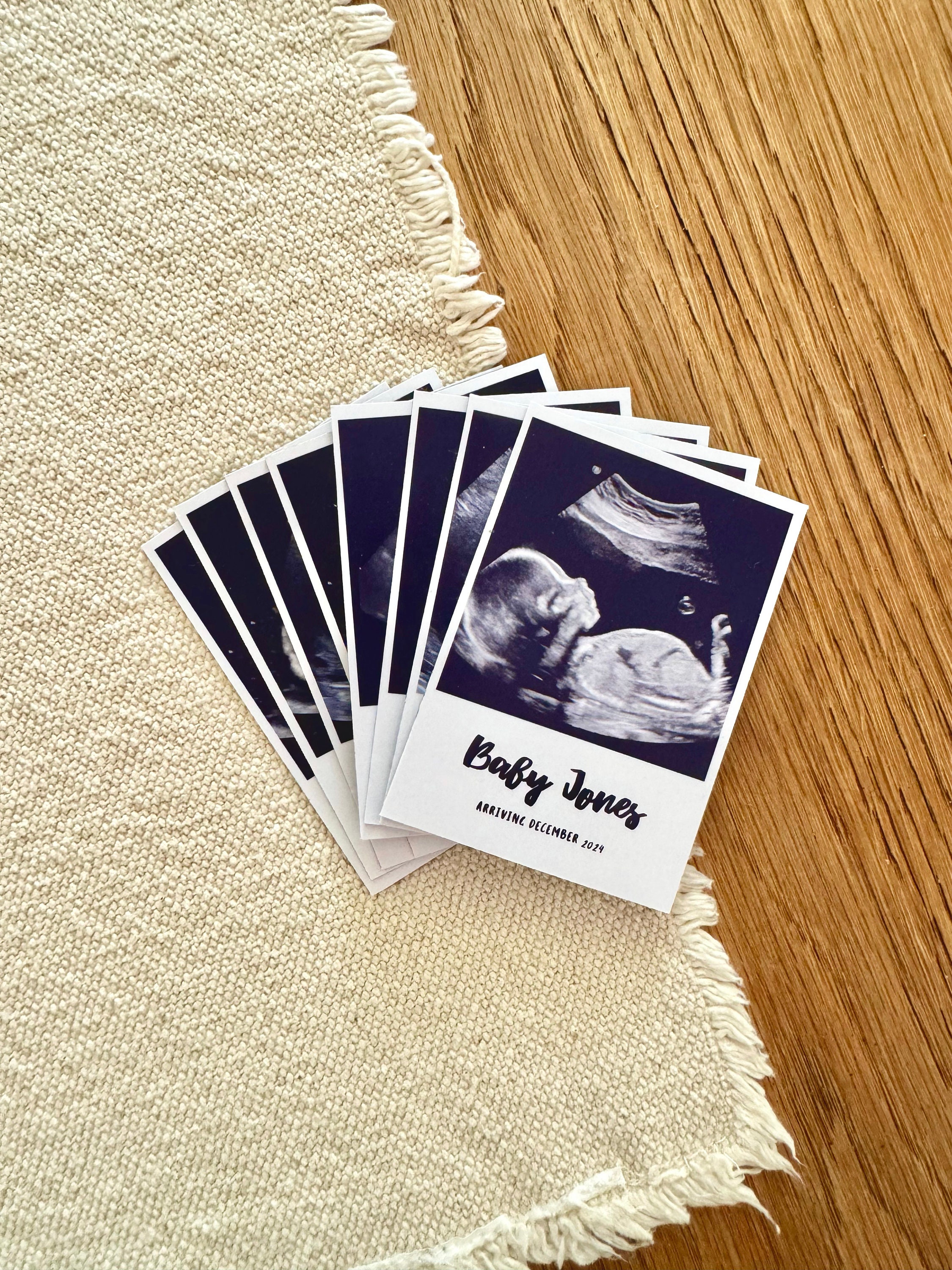 Sonogram Magnets Personalised Baby Ultrasound Magnets | Custom Keepsake | Ideal Gift for ...