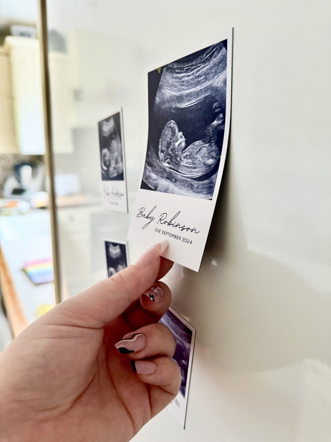 Ultrasound Photo Personalized Fridge New Parents