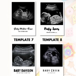 Sonogram Magnets Personalised Baby Ultrasound Magnets | Custom Keepsake | Ideal Gift for ...