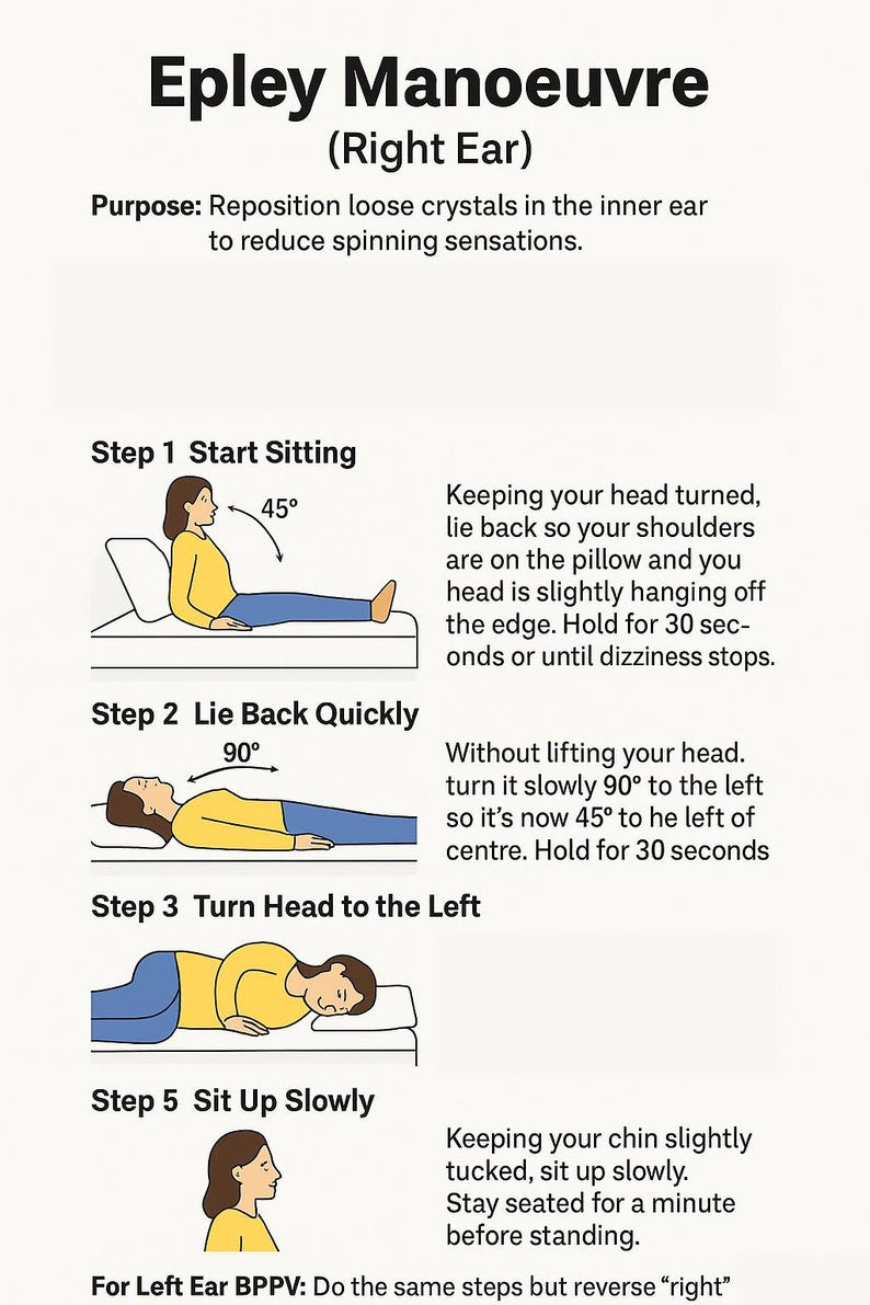 Epley Manoeuvre Printable Guide Step by step Relief For Vertigo Epley Manoeuvre Printable Guide Step by step Relief For Vertigo