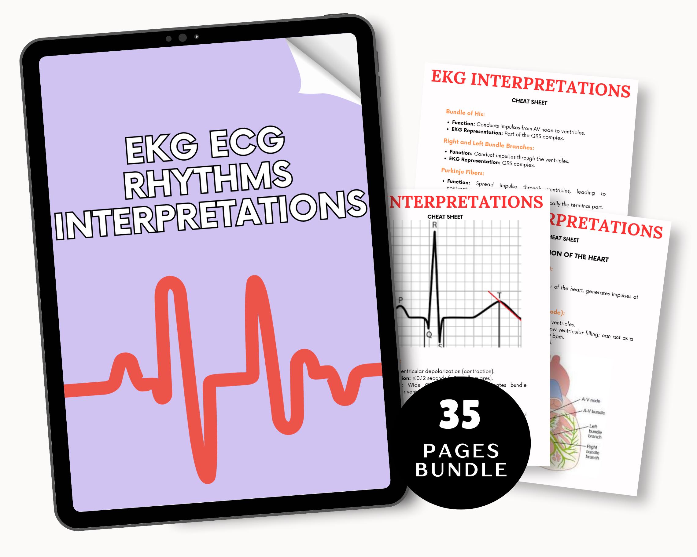 EKG Rhythm Interpretation Study Guide: Nursing Cheat Sheet (digital ...