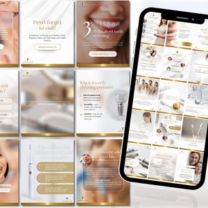 Puede incluir: Un collage de im&aacute;genes que promocionan servicios de atenci&oacute;n dental. Las im&aacute;genes muestran personas sonrientes, herramientas dentales y texto sobre temas de atenci&oacute;n dental como el blanqueamiento dental, los implantes y la ortodoncia. El texto incluye frases como "&iexcl;No olvides visitar!" y "3 Mitos sobre el blanqueamiento dental".