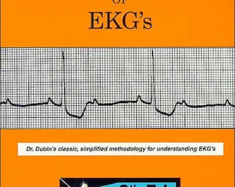 Schnelle Interpretation für EKG S