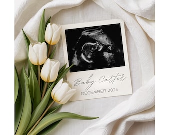 Puede incluir: Una imagen de ultrasonido en blanco y negro de un bebé en un marco blanco con el texto "Baby Carter December 2025" sobre un fondo de tela blanca con tulipanes blancos.