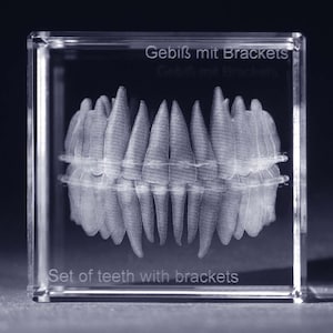 Könnte beinhalten: Ein transparenter Glaswürfel mit einem 3D-Lasergravierten Bild eines Gebisses mit Zahnspange. Der Text "Gebiss mit Brackets" und "Set of teeth with brackets" ist auf den Würfel graviert.
