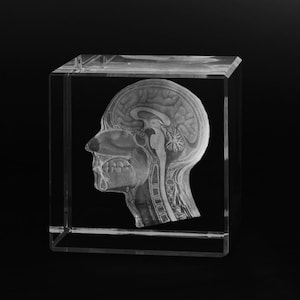 Op de afbeelding: Een transparante glazen kubus met een 3D-anatomisch model van een menselijk hoofd en nek. Het model toont de hersenen, het ruggenmerg en andere interne structuren.
