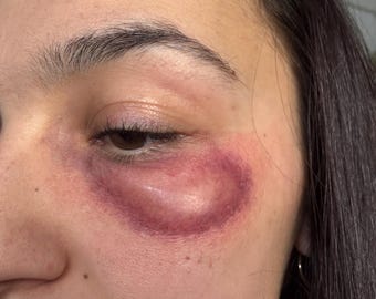 Ojos hinchados / Maquillaje desgastado / Maquillaje de efectos especiales / Prótesis de silicona / Cine y televisión / Halloween