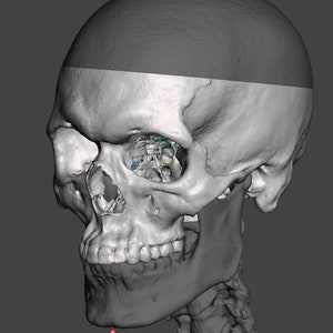 以下が含まれることがあります： 横から見た人間の頭蓋骨の3Dモデル。頭蓋骨は灰色と白で、あごに赤い点がある。