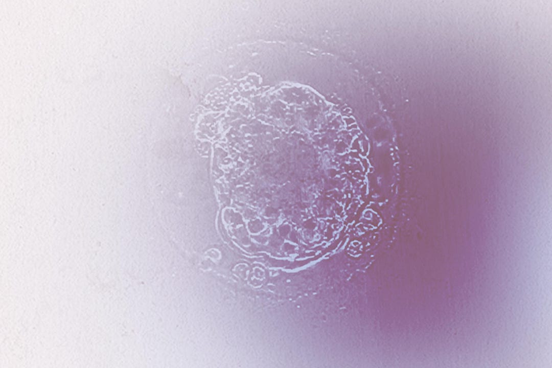 Custom Embryo Print Digital Download - Etsy