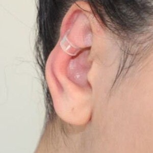 Transparent ear corrector image 1