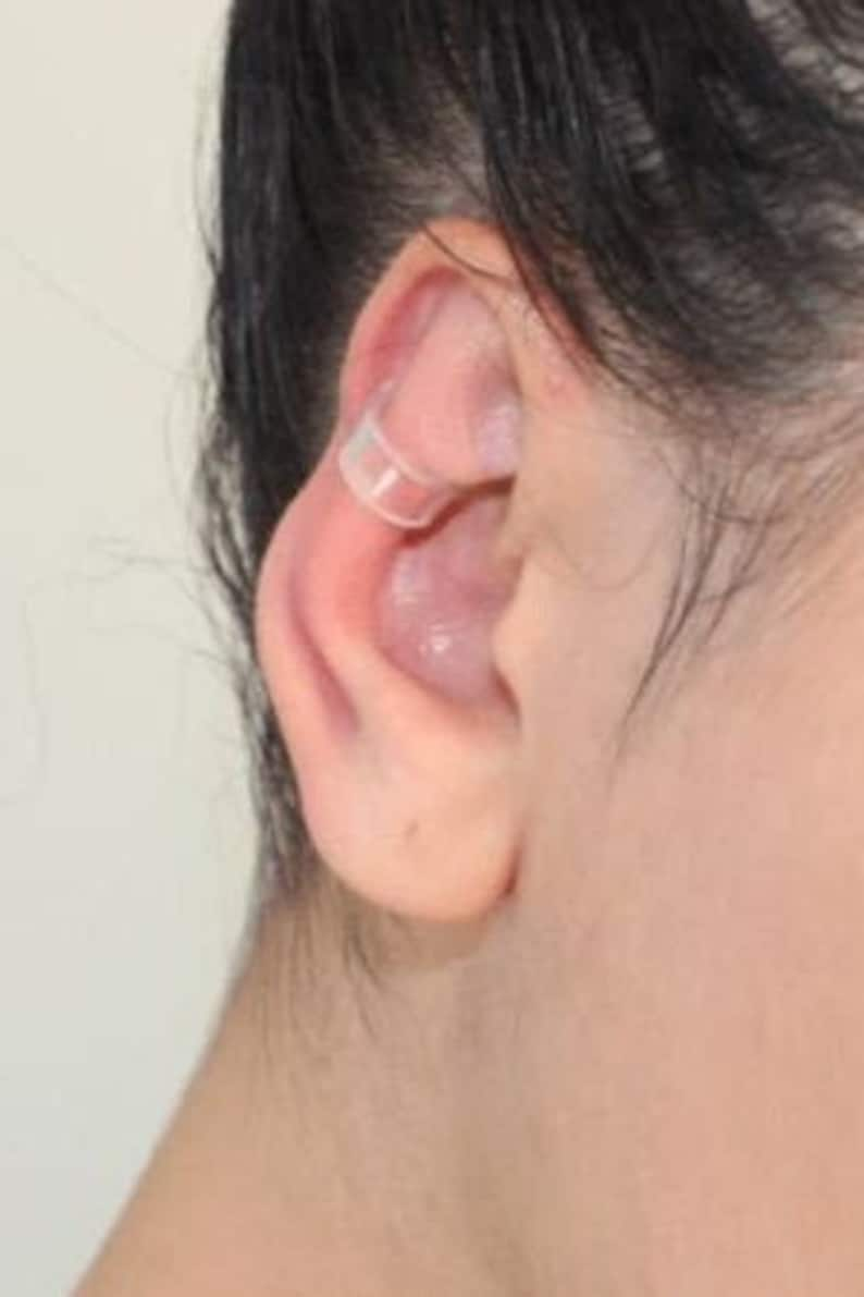 Transparent ear corrector image 1