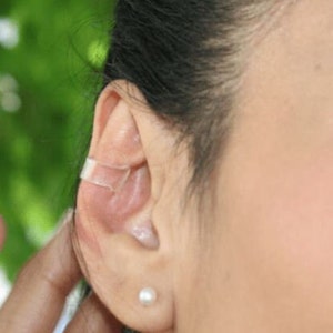 Transparent ear corrector image 2