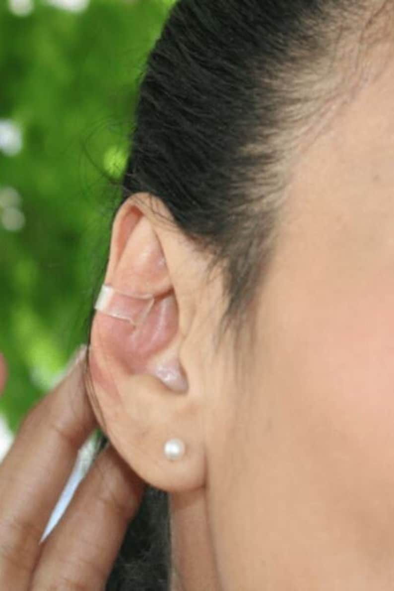 Transparent ear corrector image 2