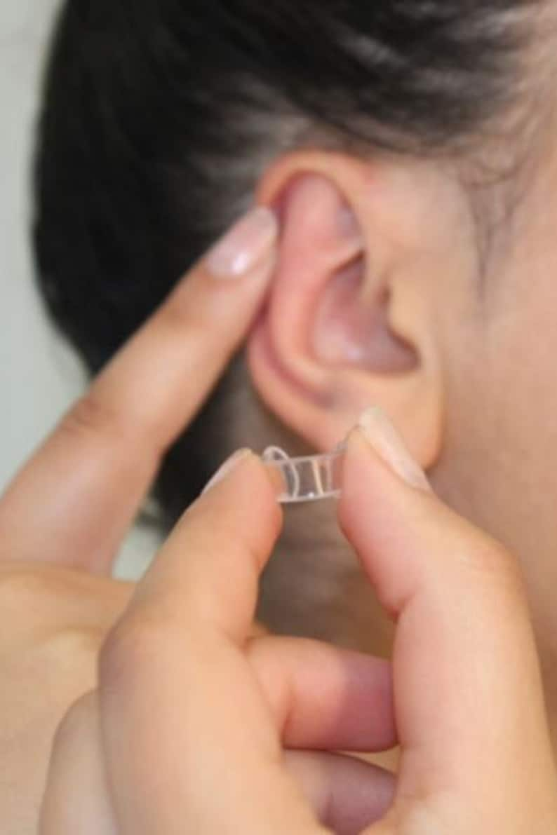 Transparent ear corrector image 3