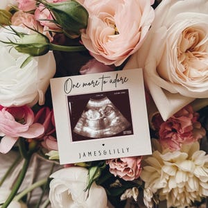May include: A square card with the text "One more to adore" and a sonogram image, surrounded by a bouquet of pink and white flowers. The names "JAMES & LILLY" are printed at the bottom of the card.