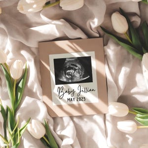 May include: A brown picture frame with a white mat and a black and white ultrasound image inside. The text "Baby Jillian MAY 2025" is printed below the image.