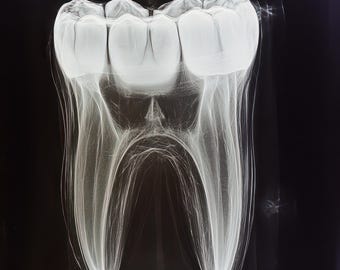 Colección de imágenes de rayos X dentales humanas para estudio médico, archivos digitales, descarga