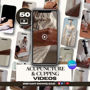 Acupuncture Videos Canva Templates | Cupping Therapy Reels | Acupuncture Social Media | TCM Instagram | Acupuncturist Chinese Medicine