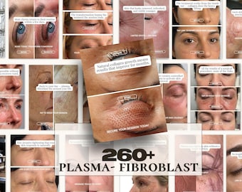260 Plasma pen Fibroblast Before & After Instagram Templates | Portrait + Story Canva | Non-Surgical Skin Tightening Fibroblast Medspa