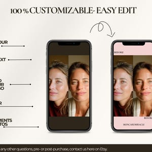 This Canva kit serves as a comprehensive content system for dermatologists, estheticians, and injectors showcasing results online. Whether highlighting acne clearance, pigmentation reduction, or texture improvement, the templates maintain clarity and professionalism. They support consistent storytelling, which increases client trust and boosts inquiry rates. The dual-size design ensures compatibility with Instagram's current display priorities and visibility trends.
