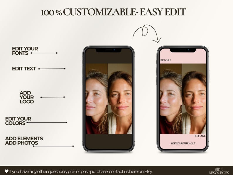 This Canva kit serves as a comprehensive content system for dermatologists, estheticians, and injectors showcasing results online. Whether highlighting acne clearance, pigmentation reduction, or texture improvement, the templates maintain clarity and professionalism. They support consistent storytelling, which increases client trust and boosts inquiry rates. The dual-size design ensures compatibility with Instagram's current display priorities and visibility trends.