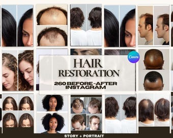 Hair restoration Before After Canva Templates | Scalp Treatment Post | Hair Growth Instagram | MedSpa Esthetician | 260 Hair Clinic Posts