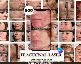Fractional Laser Instagram Templates — 600 Canva Posts & Stories | Before After Skin Resurfacing | Medspa Esthetician-Medspa Aesthetic
