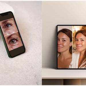 Clinics using this bundle can produce high-impact content quickly, thanks to the ready-made layouts optimized for before/after storytelling. Each template provides structured space for treatment names, protocols, and client results, helping audiences understand the value of your services. The matching post and story versions reduce design inconsistency and support smooth multi-format publishing. All assets are editable for instant personalization.