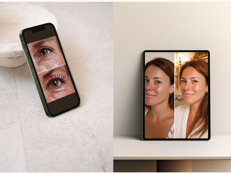 Clinics using this bundle can produce high-impact content quickly, thanks to the ready-made layouts optimized for before/after storytelling. Each template provides structured space for treatment names, protocols, and client results, helping audiences understand the value of your services. The matching post and story versions reduce design inconsistency and support smooth multi-format publishing. All assets are editable for instant personalization.