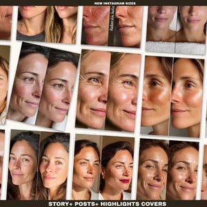 These skincare templates simplify content creation for clinics and medspas needing polished before/after posts. Each design is optimized for Instagram engagement and provides clean medical-grade aesthetics aligned with modern skincare branding. Use them to highlight facials, injectables, microneedling, laser sessions, and other treatments with consistent formatting. All templates are fully editable in free Canva for fast customization.