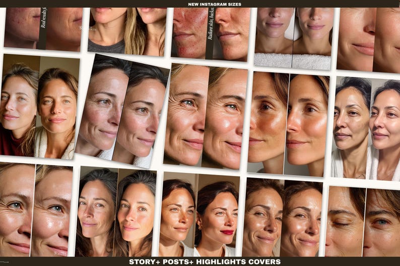 These skincare templates simplify content creation for clinics and medspas needing polished before/after posts. Each design is optimized for Instagram engagement and provides clean medical-grade aesthetics aligned with modern skincare branding. Use them to highlight facials, injectables, microneedling, laser sessions, and other treatments with consistent formatting. All templates are fully editable in free Canva for fast customization.