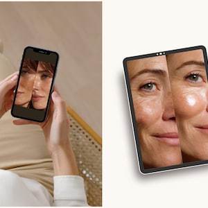 This digital kit is ideal for medspas wanting to streamline their social media operations while maintaining a professional visual identity. The templates support treatments ranging from HydraFacial to microneedling and filler sessions. Their minimalist medical focus helps differentiate clinical services from generic beauty content. Use them to improve your brand’s perceived quality and reinforce expertise through consistent before/after presentation.