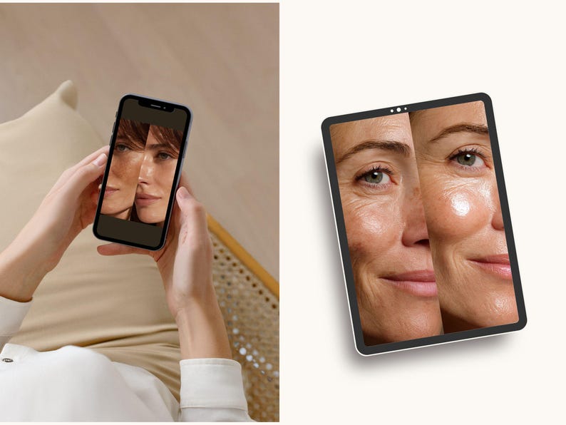 This digital kit is ideal for medspas wanting to streamline their social media operations while maintaining a professional visual identity. The templates support treatments ranging from HydraFacial to microneedling and filler sessions. Their minimalist medical focus helps differentiate clinical services from generic beauty content. Use them to improve your brand’s perceived quality and reinforce expertise through consistent before/after presentation.