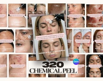 320 Chemical Peel Instagram Templates | Before After Skin Post | Esthetician Medspa Canva | Clinic Social Media | Chemical facial peel