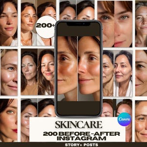 This skincare Canva template kit helps estheticians, dermatologists, nurse injectors, and medspas present high-quality before/after transformations with clarity and consistency. It includes 200 templates in two optimized Instagram sizes, allowing you to maintain a cohesive professional feed. Every layout is designed to support trust-building visuals that increase client inquiries and reinforce treatment expertise.