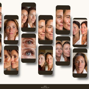 Skincare professionals seeking to scale their online presence benefit from this bundle’s structured layouts and visual discipline. Each template is designed to help clinics communicate transformations with precision and confidence. The straightforward customization process reduces content production time while maintaining high standards. The included grid planner gives teams an organized approach to long-term scheduling and brand consistency across formats.