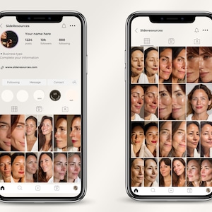 Designed for dermatology clinics and medspas, this 200-template bundle enables clear presentation of treatment results using structured, client-friendly layouts. Both posts and stories follow optimal 2026 ratios for visibility on Instagram. The templates accommodate all skin services, including chemical peels, resurfacing, dermaplaning, and injectables. Edit colors, text, and images in minutes using free Canva, with no Pro subscription required.