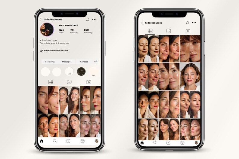 Designed for dermatology clinics and medspas, this 200-template bundle enables clear presentation of treatment results using structured, client-friendly layouts. Both posts and stories follow optimal 2026 ratios for visibility on Instagram. The templates accommodate all skin services, including chemical peels, resurfacing, dermaplaning, and injectables. Edit colors, text, and images in minutes using free Canva, with no Pro subscription required.