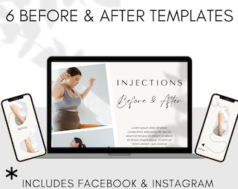 Weight Loss Social Media Templates: Before & After Posts (Digital Download)