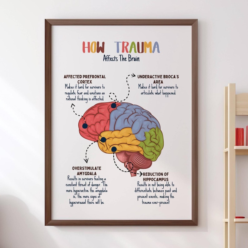 How Trauma Affects the Brain, Human Brain Poster, Therapy Office Decor ...