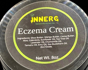 Eczema Cream