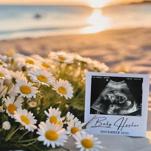 Summer Pregnancy Announcement Digital Simple Gender Neutral Beach Bum Baby Announcement Sunshine Social Media Reveal Ultrasound Template