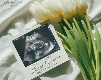 Faire-part de grossesse minimaliste simple numérique, faire-part de bébé printemps-été neutre, modèle de révélation de bébé modifiable sur les réseaux sociaux