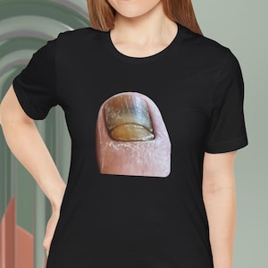 Puede incluir: Una camiseta negra con una imagen de primer plano de una uña del pie con una decoloración amarilla y verde.