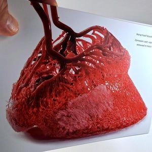 May include: A close-up of a red horse hoof blood vessel cast. The cast is made of a corrosion cast, with the capillaries removed in most areas.