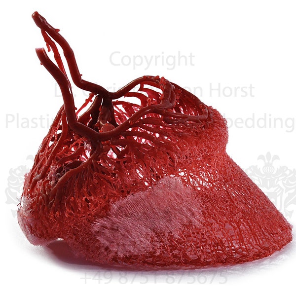 Equine hoof blood vessel cast hoof venogram corium vascularisation image print