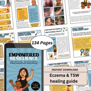 Gids voor eczeemgenezing e-boek Hoofdoorzaak Ondersteuning TSW Darmgezondheid en natuurlijke genezing
